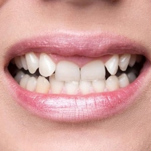 Trước điều trị